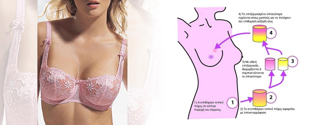 Αυξητική Στήθους με Αυτομεταμόσχευση Λίπους