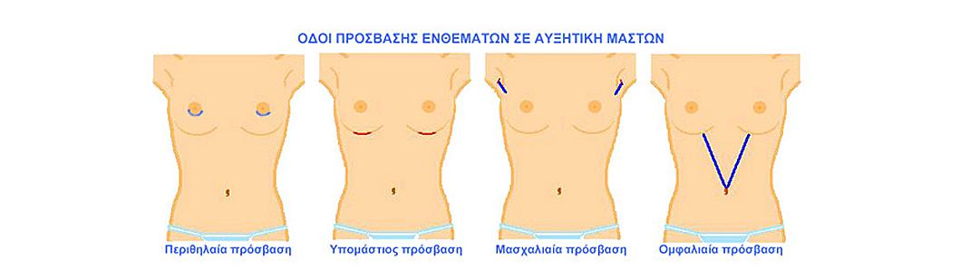 Οδοί Πρόσβασης ενθεμάτων