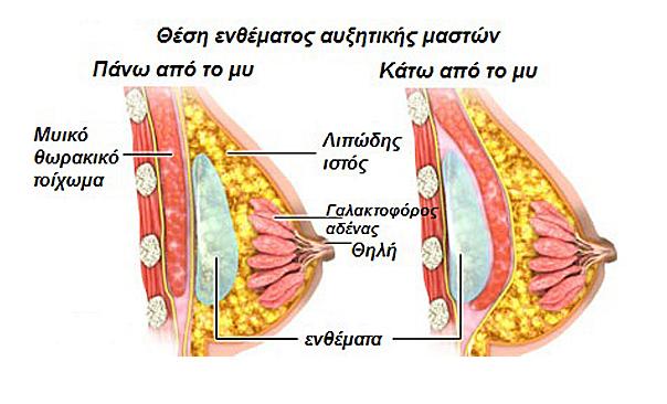 Θέση Ενθέματος