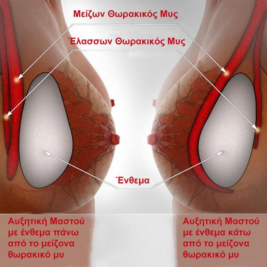 Θωρακικός μυς