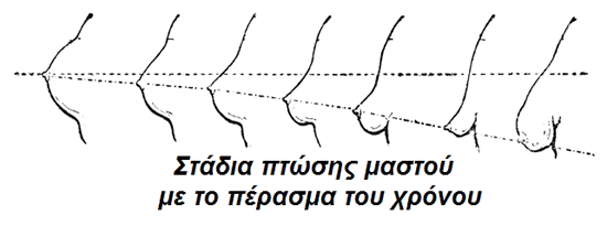 Ανόρθωση στήθους και Αυξητική