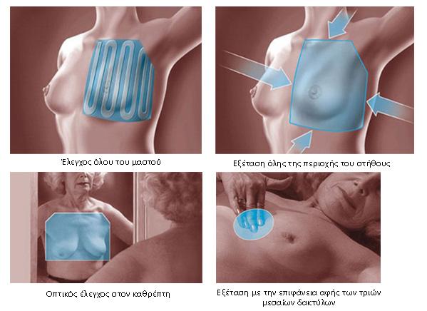 Αυτοεξέταση Μαστών
