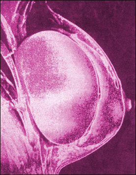Διατήρηση καλού αποτελέσματος